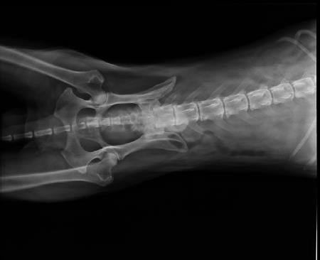 Helsin Röntgenbild